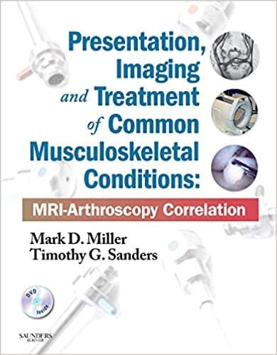 Presentation Imaging and Treatment of Common Musculoskeletal Conditions: MRI-Arthroscopy Correlation With DVD 2012 By Miller Publisher Elsevier