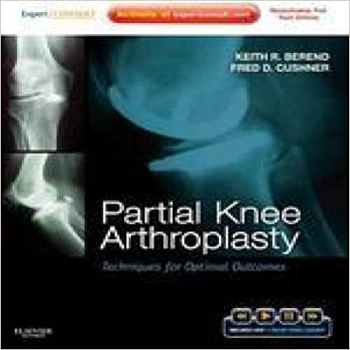 Partial Knee Arthroplasty: Techniques for Optimal Outcomes 2012 By Berend Publisher Elsevier