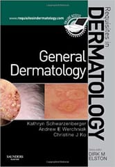 Requisites in Dermatology: General Dermatology 2009 By Schwarzenberger Publisher Elsevier