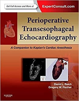 Perioperative Transesophageal Echocardiography 2014 By Reich Publisher Elsevier