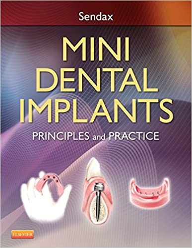 Mini Dental Implants: Principles and Practice 2013 By Sendax V. Publisher Elsevier