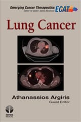 Lung Cancer 2012 By Argiris Publisher Demos Medical