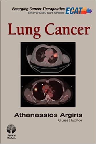 Lung Cancer 2012 By Argiris Publisher Demos Medical