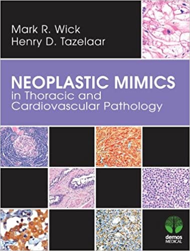 Neoplastic MIMICS in Thoracis & Cardiovascular Pathology 2013 By Wick Publisher Demos Medical