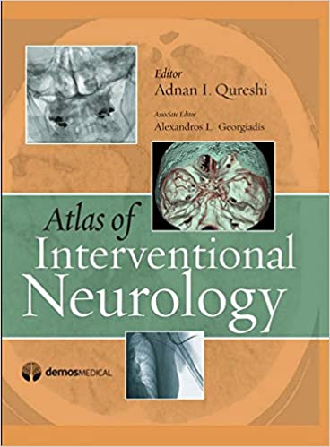 Atlas of Interventional Neurology 2009 By Qureshi Publisher Demos Medical