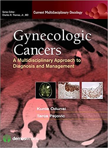 Gynecology Cancers 2014 By Odunsi Publisher Demos Medical