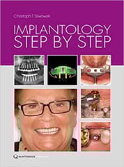 Implantology Step by Step  2015 By Sliwowski Publisher Quintessence Publishing