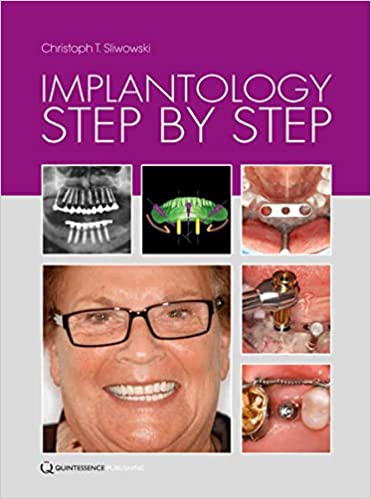 Implantology Step by Step  2015 By Sliwowski Publisher Quintessence Publishing