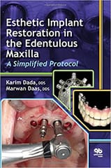 Esthetic Implant Restoration in the Edentulous Maxilla: A Simplified Protocol  2014 By Dada Publisher Quintessence Publishing