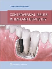 Controversial Issues in Implant Dentistry  2013 By Alfaro Publisher Quintessence Publishing