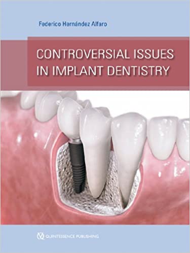 Controversial Issues in Implant Dentistry  2013 By Alfaro Publisher Quintessence Publishing