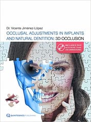 Occlusal Adjustments in Implants and Natural Dentition: 3D Occlusion With DVD Rom  2016 By Jimenez-Lopez Publisher Quintessence Publishing