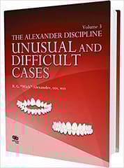 The Alexander Discipline Unusual and Difficult Cases Vol 3  2016 By Alexander Publisher Quintessence Publishing
