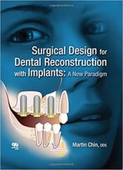 Surgical Design for Dental Reconstruction with Implants: A New Paradigm  2016 By Chin Publisher Quintessence Publishing