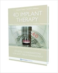 4D Implant Therapy: Esthetic Considerations for Soft Tissue Management  2008 By Funato Publisher Quintessence Publishing
