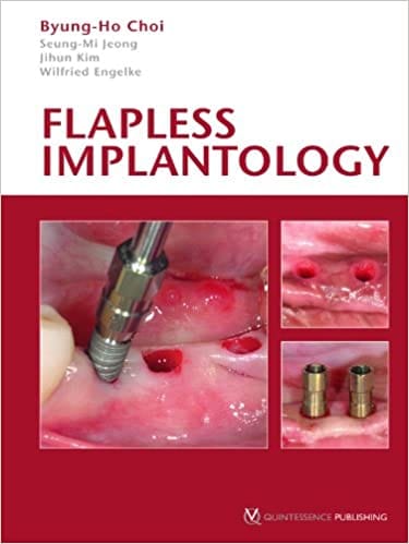 Flapless Implantology  2008 By Choi Publisher Quintessence Publishing