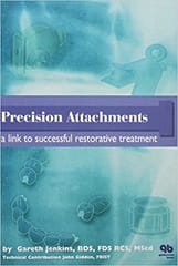 Precision Attachments: A Link to Successful Restorative Treatment  1999 By Jenkins Publisher Quintessence Publishing