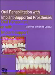 Oral Rehabilitation with Implant-Supported Prostheses  1999 By Jimenez-Lopez Publisher Quintessence Publishing