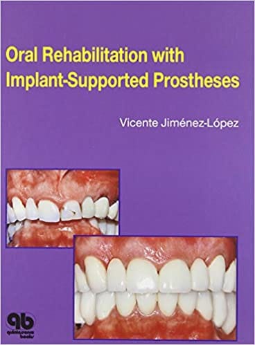 Oral Rehabilitation with Implant-Supported Prostheses  1999 By Jimenez-Lopez Publisher Quintessence Publishing