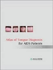 Atlas of Tongue Diagnosis for AIDS Patients  2006 By Peng Bo Publisher PMPH & BC DECKER