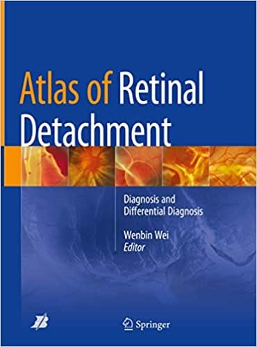 Atlas of Retinal Detachment 2018 By Wei Publisher Springer