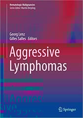 Aggressive Lymphomas 2018 By Lenz G. Publisher Springer