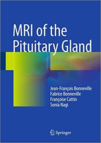 MRI of the Pituitary Gland 2016 By Bonneville Publisher Springer