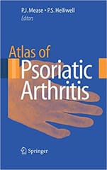 Atlas of Psoriatic Arthritis 2008 By Mease Publisher Springer