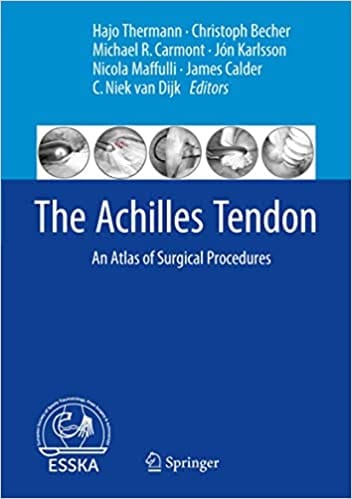 The Achilles Tendon: An Atlas of Surgical Procedures 2017 By Thermann Publisher Springer