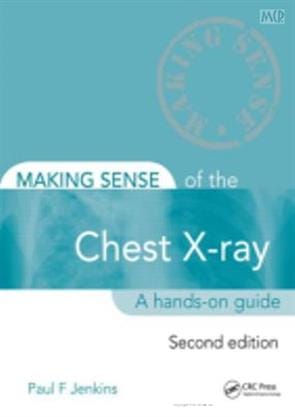 Making Sense of the Chest X Ray: A Hands on Guide 2nd Edition 2020 By Jenkins PF Publisher Taylor & Francis