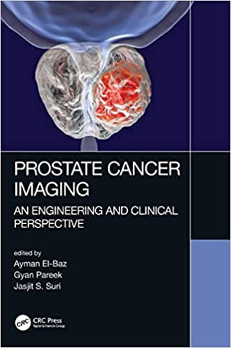 Prostate Cancer Imaging: An Engineering and Clinical Perspective 2019 By El-Baz Publisher Taylor & Francis