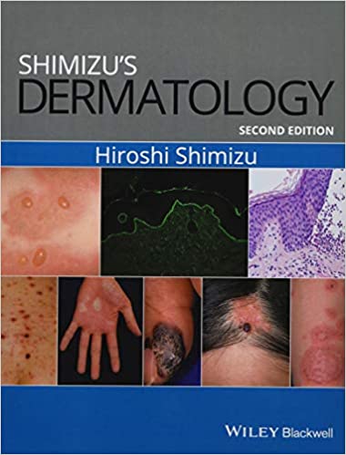 Shimizu's Dermatology 2nd Edition 2017 By Shimizu Publisher Wiley