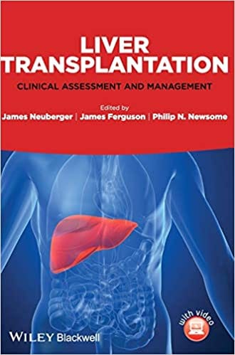 Liver Transplantation 2014 By Neuberger Publisher Wiley