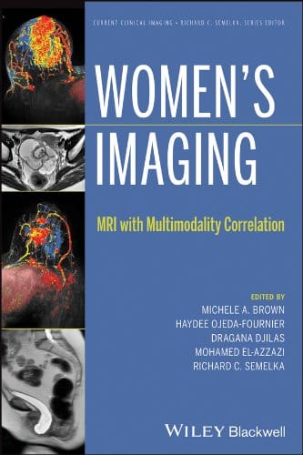 Women's Imaging: MRI with Multimodality Correlation 2014 By Brown Publisher Wiley