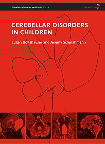 Cerebellar Disorders in Children 2012 By Boltshauser Publisher Wiley