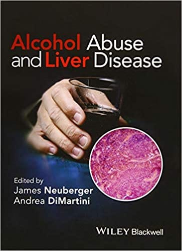 Alcohol Abuse and Liver Disease 2015 By Neuberger Publisher Wiley