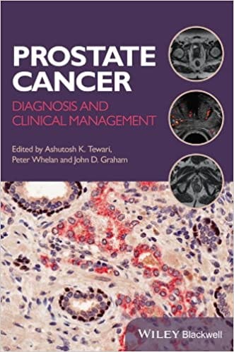 Prostate Cancer: Diagnosis & Clinical Management 2014 By Tewari Publisher Wiley