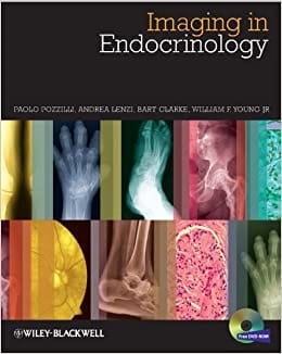 Imaging in Endocrinology 2014 By Pozzilli Publisher Wiley