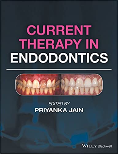Current Therapy in Endodontics 2016 By Jain Publisher Wiley