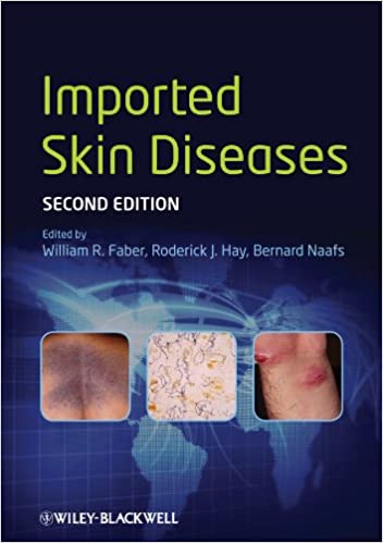 Imported Skin Diseases 2nd Edition 2013 By Faber Publisher Wiley