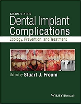 Dental Implant Complications: Etiology Prevention and Treatment 2nd Edition 2016 By Stuart J Froum