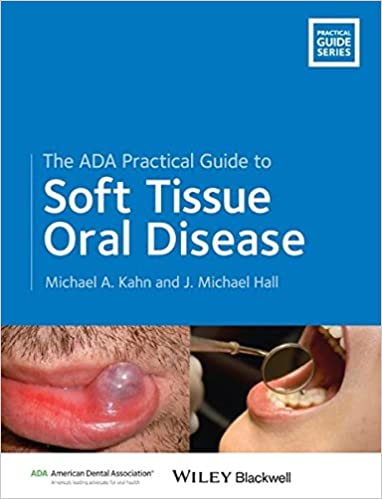 The ADA Practical Guide to Soft Tissue Oral Disease 2014 By Kahn Publisher Wiley