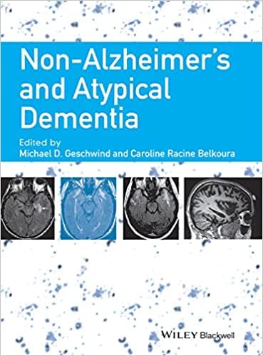 Non Alzheimer's and Atypical Dementia 2016 By Geschwind Publisher Wiley
