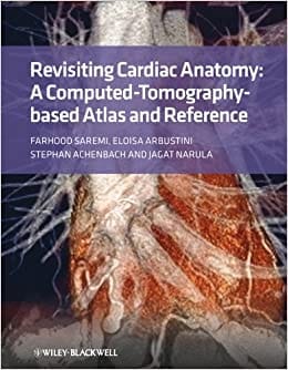 Revisiting Cardiac Anatomy: A Computed Tomography Based Atlas and Reference 2011 By Saremi Publisher Wiley