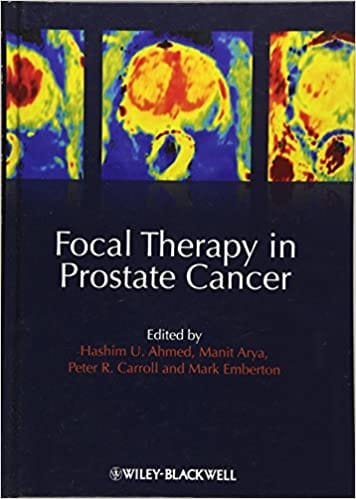 Focal Therapy in Prostate Cancer 2012 By Ahmed Publisher Wiley