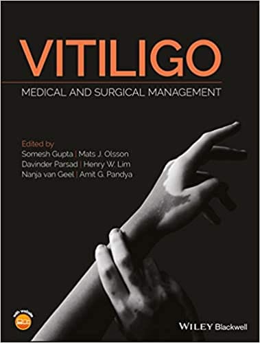 Vitiligo: Medical and Surgical Management 2018 By Gupta Publisher Wiley