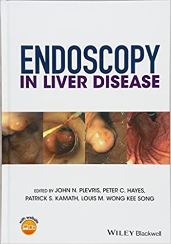 Endoscopy in Liver Disease 2018 By Plevris Publisher Wiley