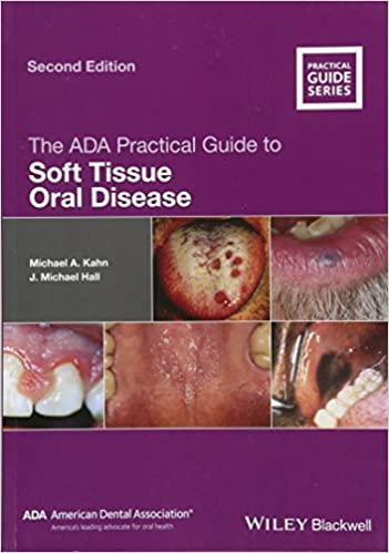 The ADA Practical Guide to Sofe Tissue Oral Disease 2nd Edition 2014 By Kahn Publisher Wiley