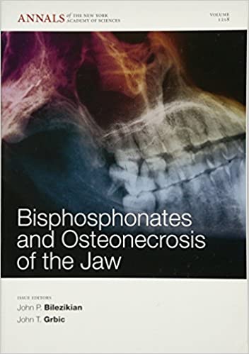 Bisphosphonates and Osteonecrosis of the Jaw 2011 By Grbic Publisher Wiley