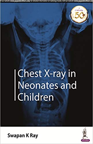 Chest X-Ray In Neonates And Children 1st Edition 2019 By Swapan K Ray